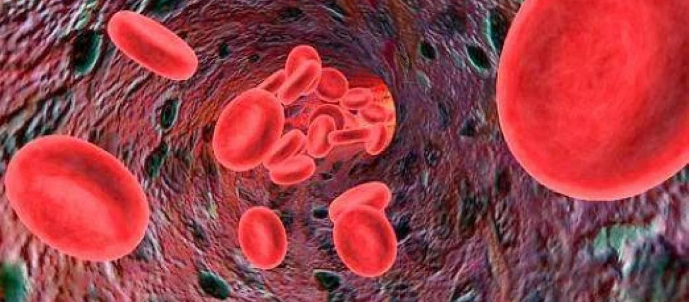 Ποια νόσο κρύβει ο αυξημένος αιματοκρίτης;